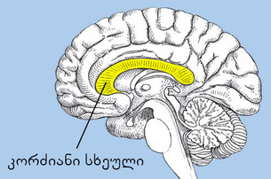 კორძიანი სხეული