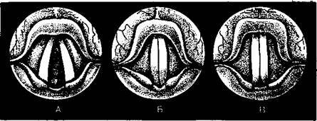 სახმო სიმების სამი მდგომარეობა